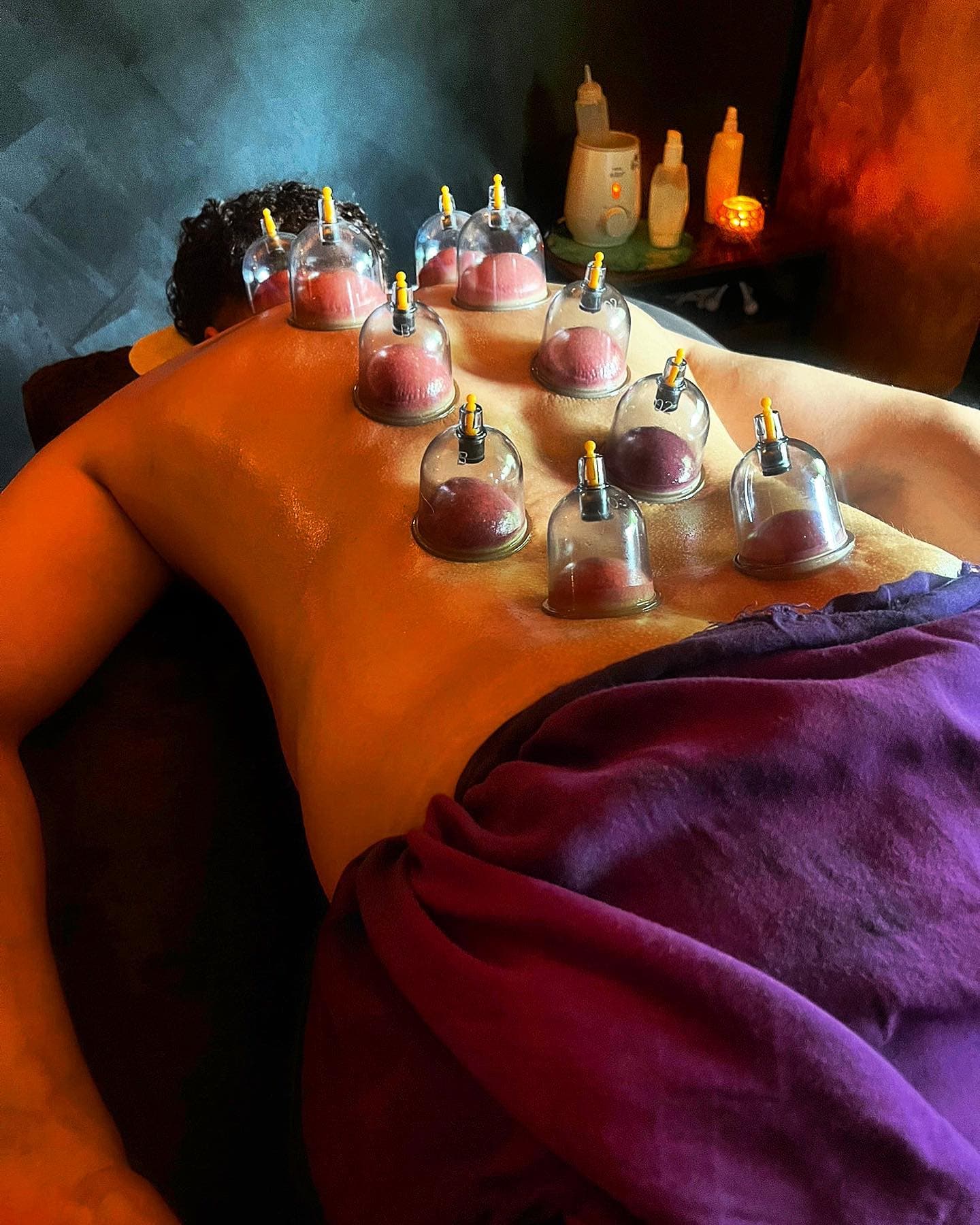 Schröpf-Behandlung im Studio Massage Issel