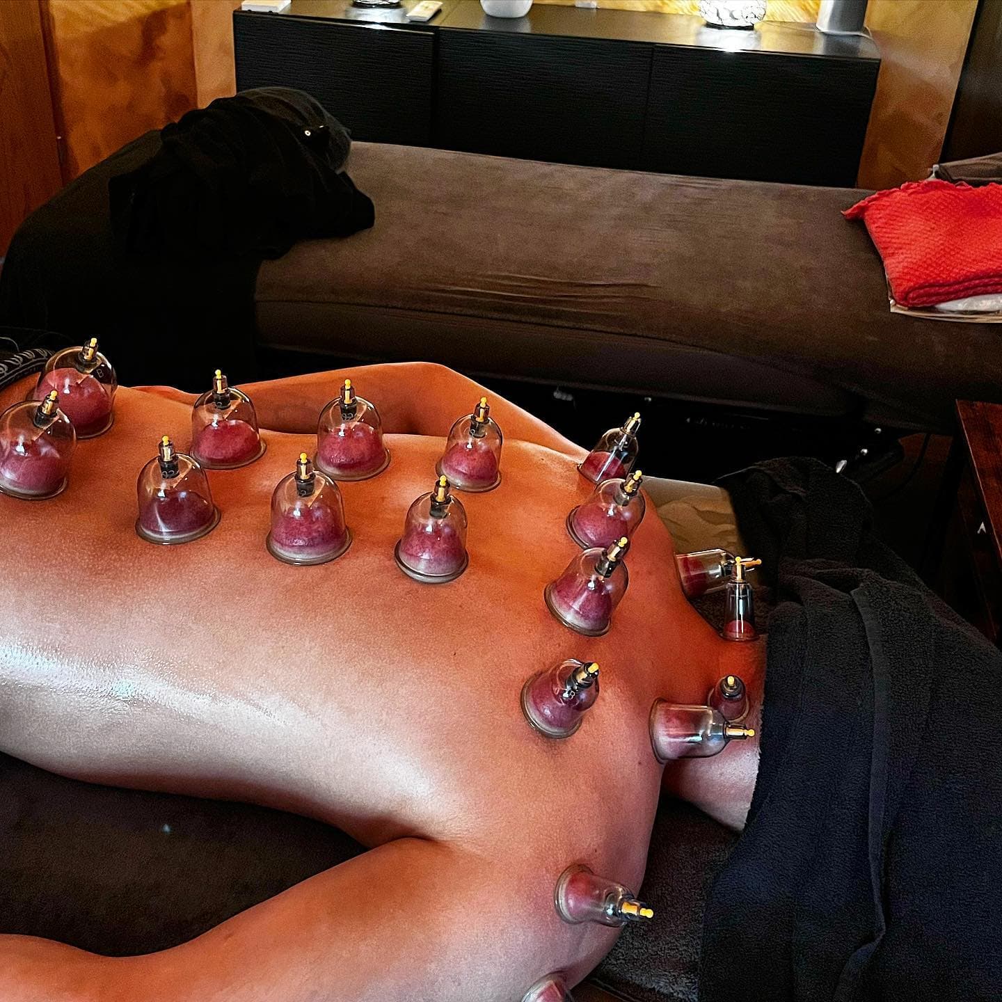 Entspannende Schröpfbehandlung bei Massage Issel